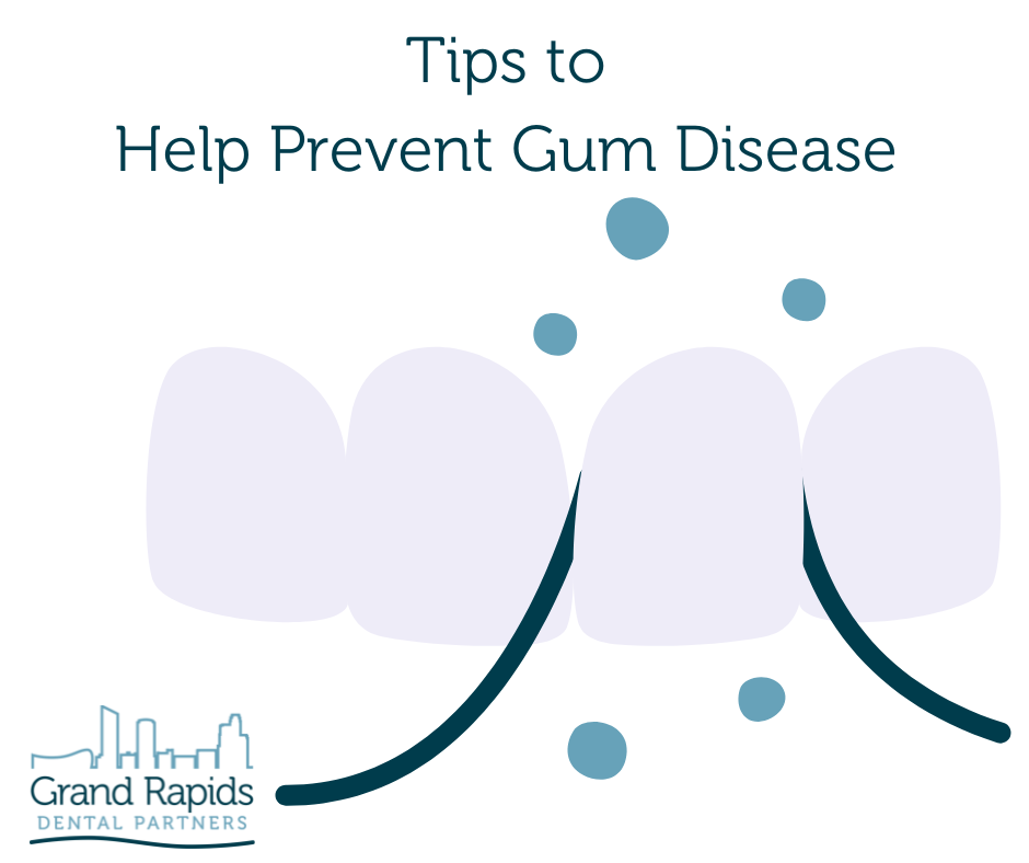 Tips to help prevent gum disease - Grand Rapids Dental Partners