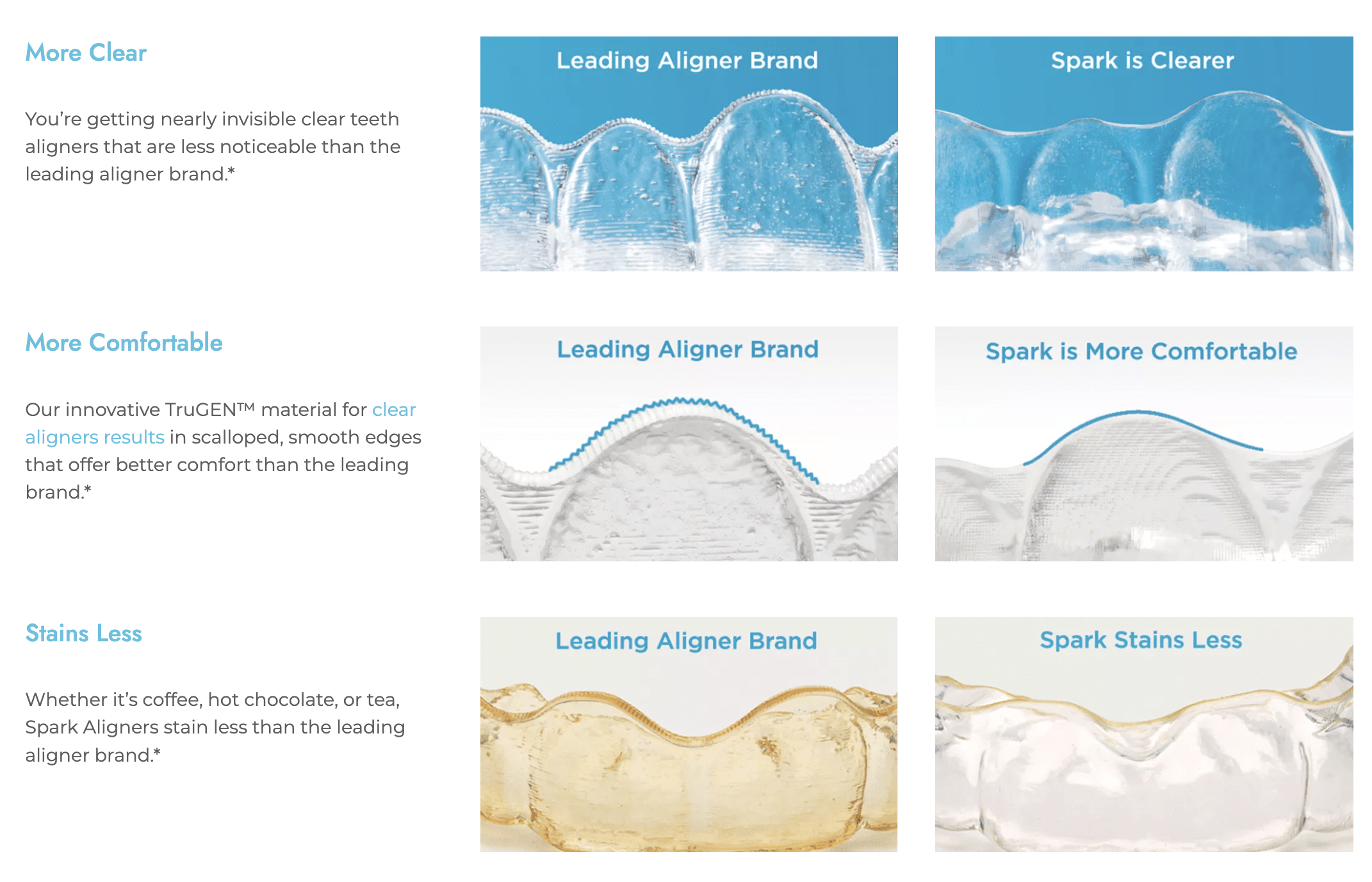 Spark Clear Aligners Grand Rapids